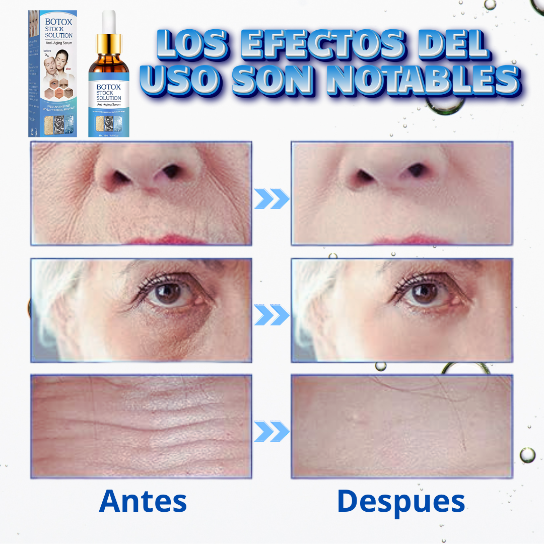 Botox Stock Solution Suero antiarrugas 2 X 1 Compra 1 y tellevas 2 🎁
