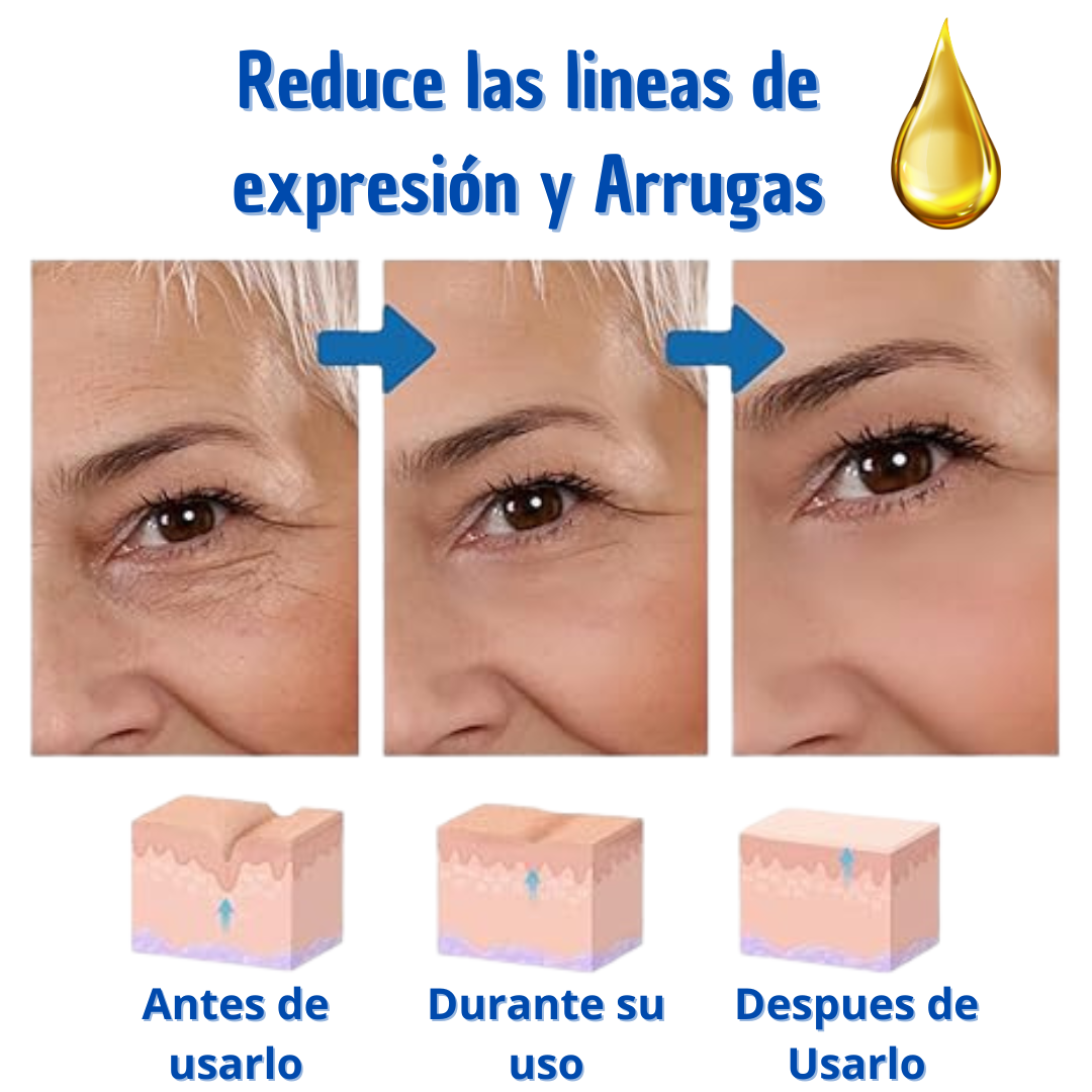 Botox Stock Solution Suero antiarrugas 2 X 1 Compra 1 y tellevas 2 🎁