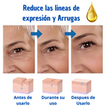 Botox Stock Solution Suero antiarrugas 2 X 1 Compra 1 y tellevas 2 🎁